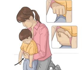 Clip bác sĩ dùng động tác Heimlich cứu mạng em bé khiến dân thán phục  第2张