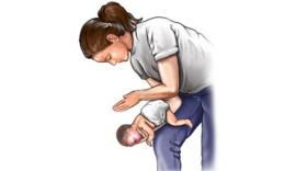 Clip bác sĩ dùng động tác Heimlich cứu mạng em bé khiến dân thán phục  第3张